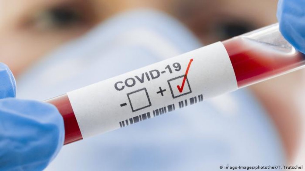 COVID în Moldova: Alte 424 cazuri noi de infectare au fost confirmate astăzi, dintre care 4 lucrători medicali
