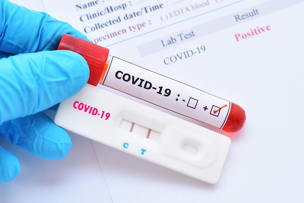 Alți 224 de moldoveni au fost testați pozitiv cu COVID-19. Numărul total a ajuns la 253.173