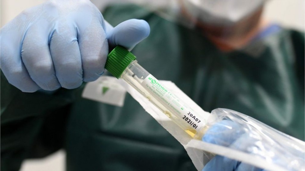 Islanda a testat 10% din populaţie pentru noul coronavirus